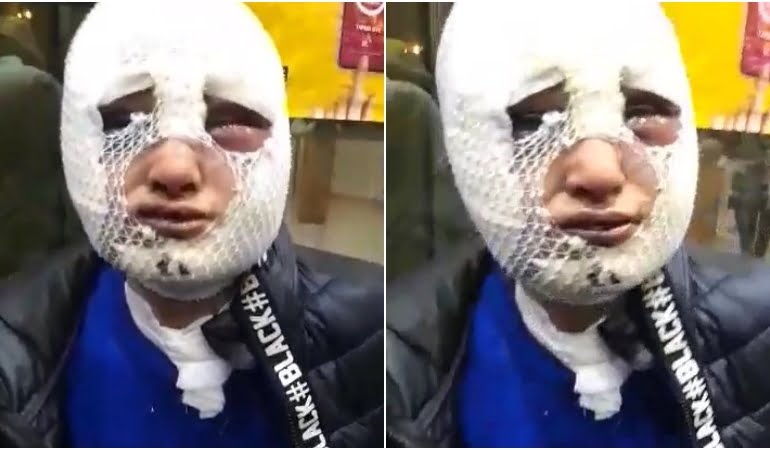 Yüzünü kızgın yağla yaktı, istismar etti… Tahliye edildi!