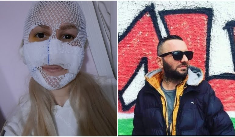 Yüzüne kimyasal madde attı, ev hapsi kaldırıldı!