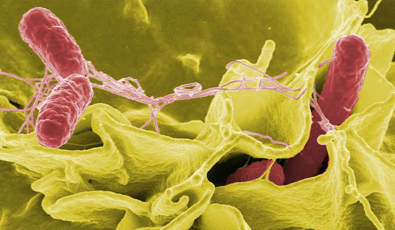 DSÖ: 11 ülkeden 151 Salmonella vakası bildirildi
