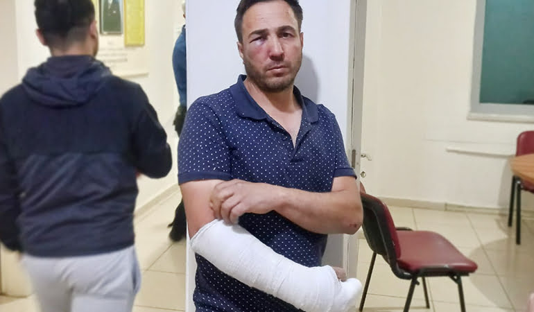 Polis çevirmesine girmeyen vatandaş hastanelik olana kadar dövüldü
