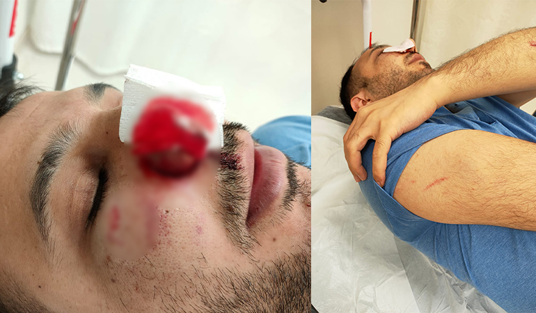 Hastanede sağlık çalışanına saldırı… ‘Can güvenliğimiz yok’