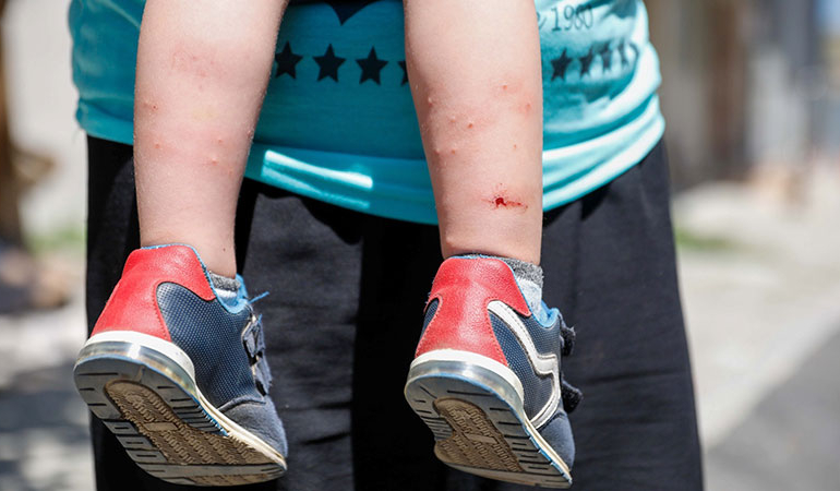 İstanbul’da ‘Aedes’ paniği: ‘Pencereleri açamıyoruz…’