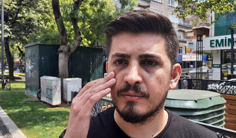 Hemşirenin burnunu kıran hasta yakınıyla ilgili yeni gelişme