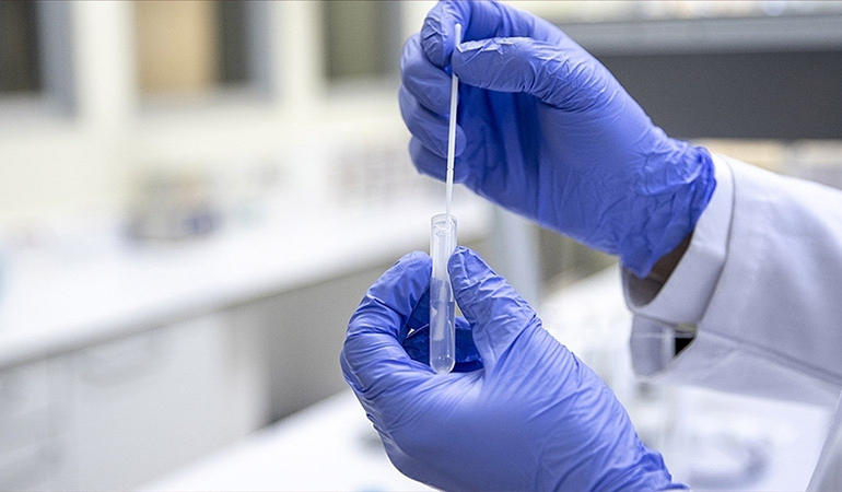 Aynı gün maymun çiçeği, Kovid-19 ve HIV testi pozitif çıktı