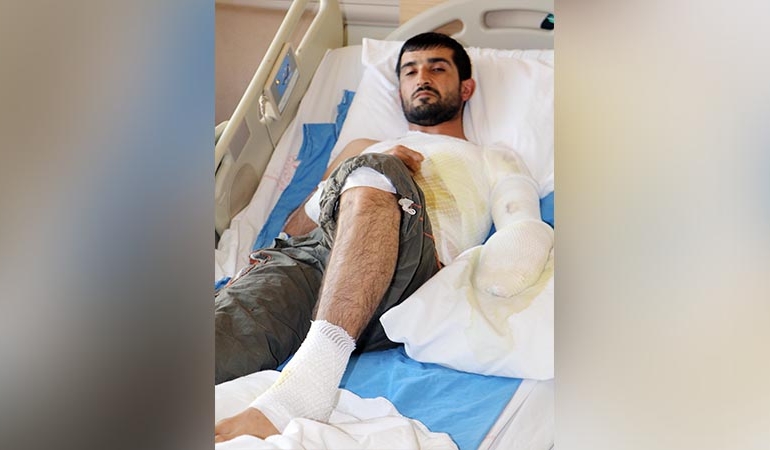 Epilepsi nöbeti geçirirken çorba kazanına düştü