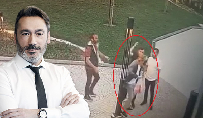 Yaptığı ameliyatla tıp literatürüne giren profesöre saldırı