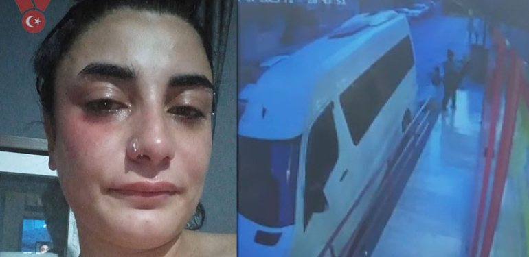 Köpeğiyle markete girmek isteyen hamile kadına saldırı… Bebeğini kaybetti