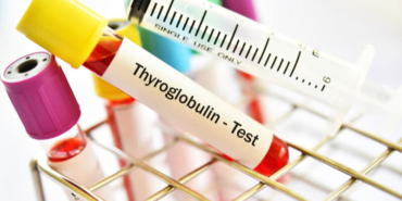 tiroglobulin-testi-nedir-yuksekl