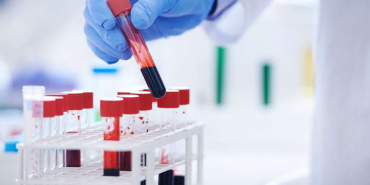 MCHC Test