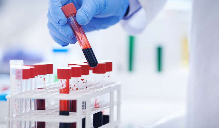 MCHC nedir? MCHC yüksekliği ve düşüklüğü ne anlama gelir?