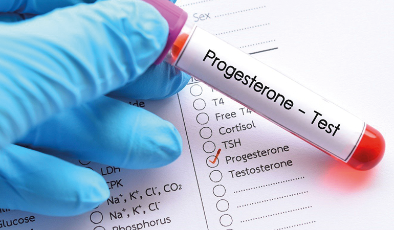 Progesteron nedir? Eksikliği nasıl anlaşılır?