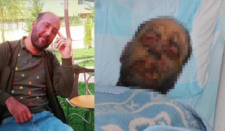 Yağmur ormanlarındaki hastalık Erzurum’da: Yüzü tanınmaz hale geldi