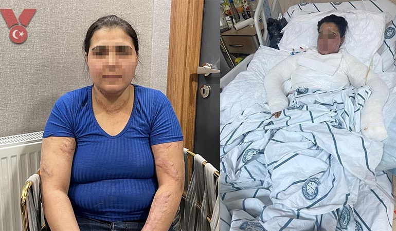 Vücuduna ütü basıp kolonyayla yakmaya çalıştılar… ‘Beni öldürecekler’