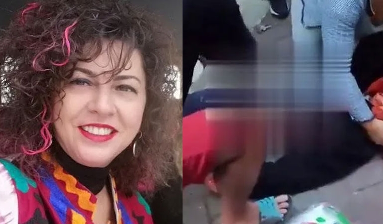 Ankara’da evine dönen akademisyene köpekler saldırdı