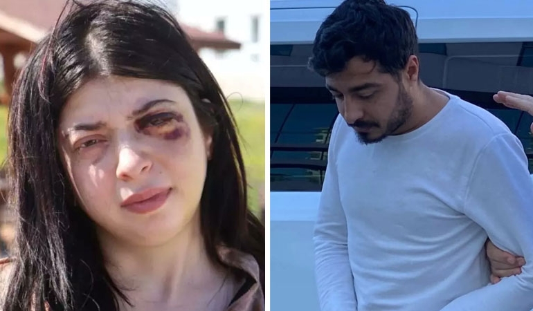 ‘Etek’ bahanesiyle tacize uğramış ve darbedilmişti: Damla Korkmaz sıvı ile beslenecek