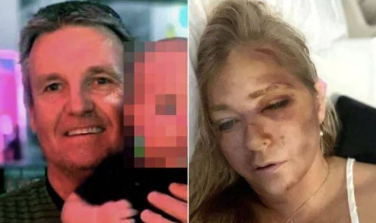 Epstein davası: Prens Andrew’u cinsel saldırıyla suçlayan tanık, trafik kazası geçirdi
