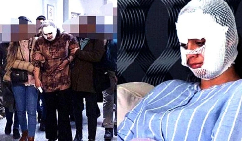 Diyarbakır’da eşinin yüzünü bıçakla parçaladı… Cezasında indirim uygulandı!