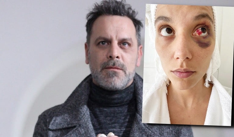 Ozan Güven’in hapis cezası onandı: Cezaevine girebilir