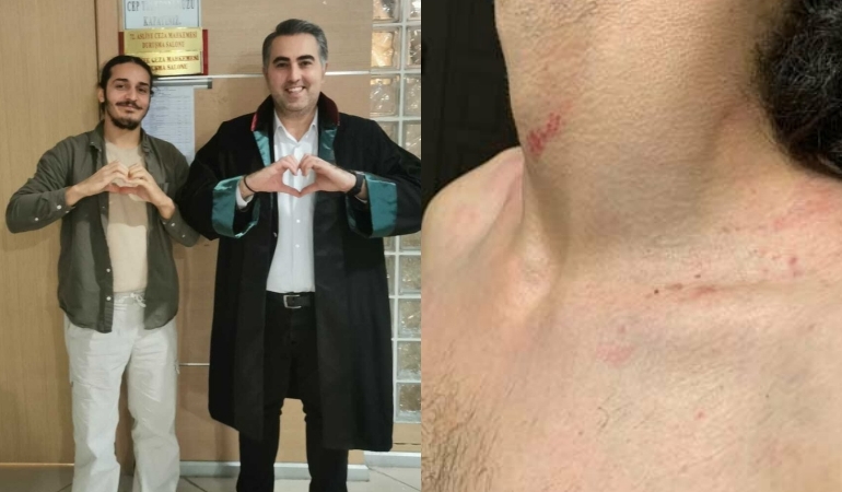 Süleyman Soylu’ya ‘kalp işareti’ yapan genci darbeden polise adli para cezası