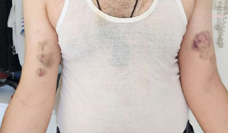 Kahramanmaraş’ta kamu mühendisine amirlerinden darp iddiası